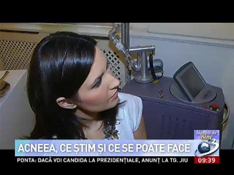 Numai de bine: Acneea, ce stim si ce se poate face