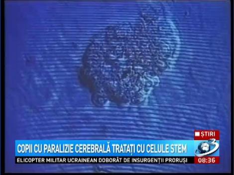 Copii cu paralizie cerebrală trataţi cu celule stem