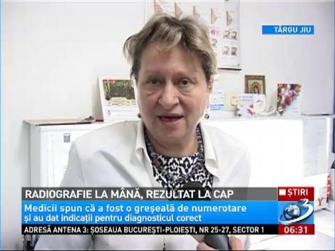 Radiografie la mână, rezultat la cap