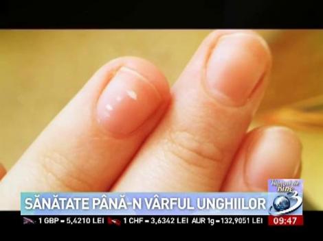 Numai de bine: Sănătate până-n vârful unghiilor