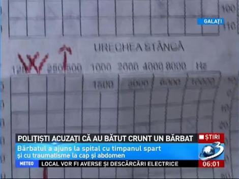 Poliţişti acuzaţi că au bătut crunt un bărbat