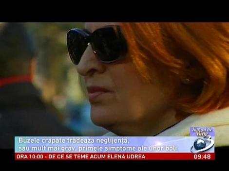 NUMAI DE BINE. Buzele crăpate, între neglijenţă şi boală