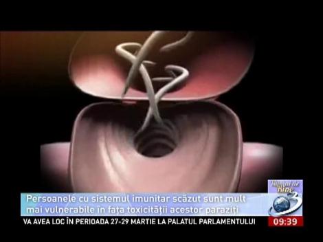 Numai de bine: Paraziţii, duşmanii ascunşi ai stării de bine