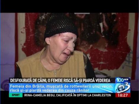 Desfigurată de c&acirc;ini, o femeie riscă să-şi piardă vederea