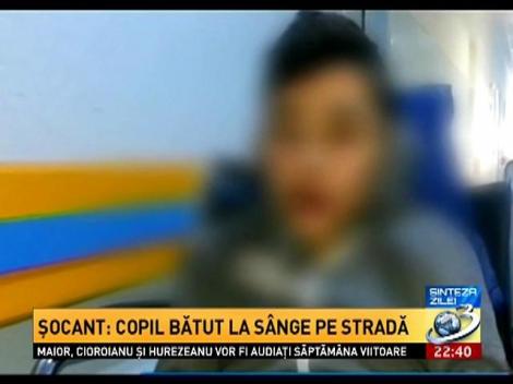 Sinteza Zilei: ŞOCANT! Copil bătut la sânge în plină stradă