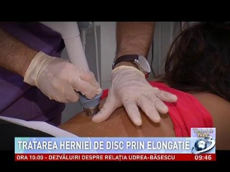 Numai de bine: Tratarea herniei de disc prin elongaţie