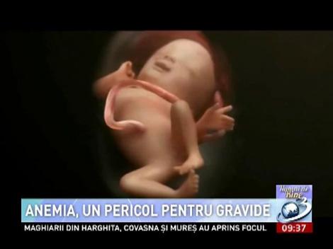 Numai de bine. Anemia, un pericol pentru gravide