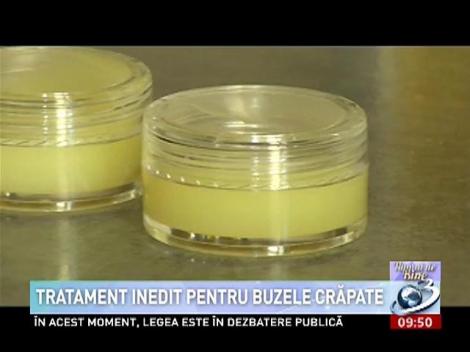 Tratament inedit pentru buzele crăpate