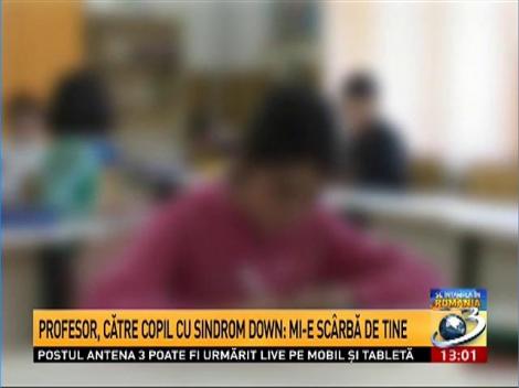 Profesor, către copil cu sindromul Down: Mi-e sc&acirc;rbă de tine