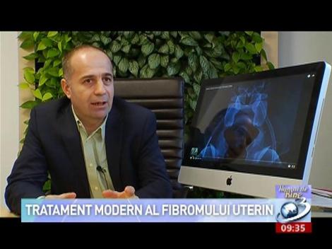 Rom&acirc;nia, fruntașă la numărul de cazuri rezolvate de fibrom uterin