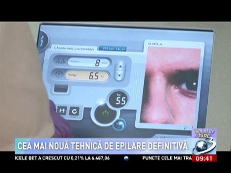 Cea mai nouă tehnică de epilare definitivă