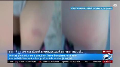 Fetiță de 8 ani bătută crunt, salvată de prietenul său