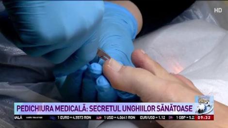 Pedichiura medicală: secretul unghiilor sănătoase