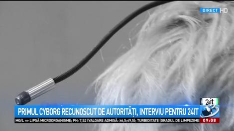 Povestea lui Neil, primul cyborg de pe Pământ: „Văd lucrurile mult mai clar decât un om obișnuit. Avantajul tehnologiei”