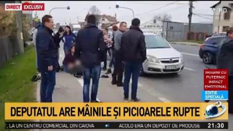 Deputatul are m&acirc;inile și picioarele rupte