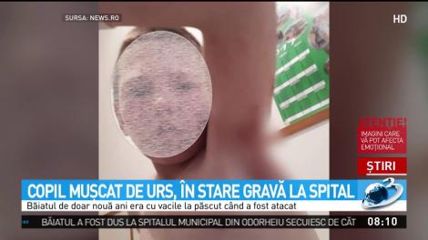 Copil mușcat de urs, &icirc;n stare gravă la spital