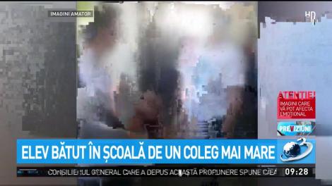 Elev bătut &icirc;n şcoală de un coleg mai mare