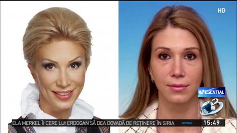 Apariţii dezastruoase ale politicienilor. Fotografii &icirc;nainte şi după operaţiile estetice