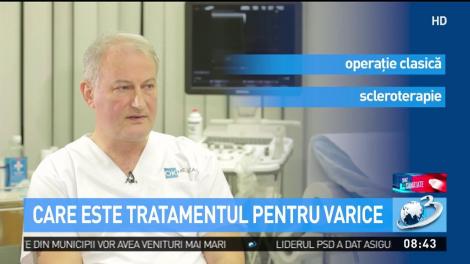 De la ce apar varicele