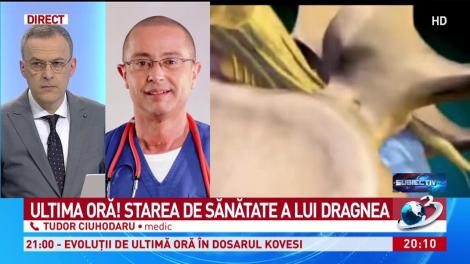 Ce &icirc;nseamnă dublă hernie de disc, afecțiune de care suferă Liviu Dragnea
