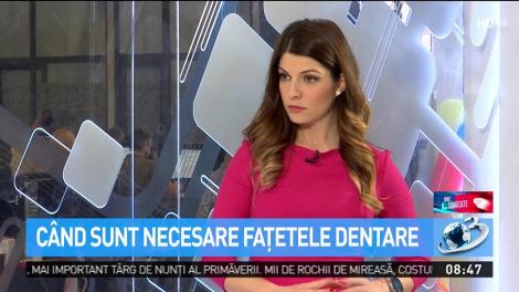 Sfat de Sănătate. Avantajele fațetelor dentare și cum le &icirc;ngrijim