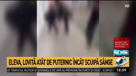 O elevă, bătută crunt de o colegă, la o școală din Botoșani! A lovit-o până când a scuipat sânge! Atenție, imagini tulburătoare – Video