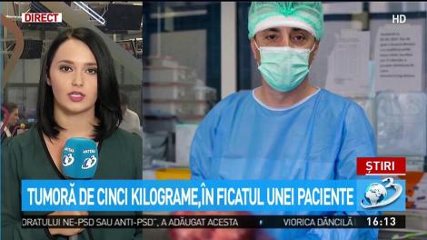 O tumoră de cinci kilograme a fost scoasă, cu succes, din ficatul unui pacient! Operația- maraton a avut loc la Spitalul Militar din București