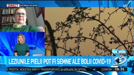 Leziunile pielii pot fi semne ale bolii COVID-19