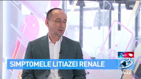 De ce apar pietrele la rinichi. Care este tratamentul litiazei renale