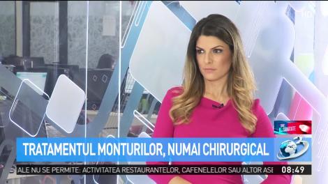 Sfat de Sănătate. De la ce apar monturile şi c&acirc;nd este cazul să ne operăm