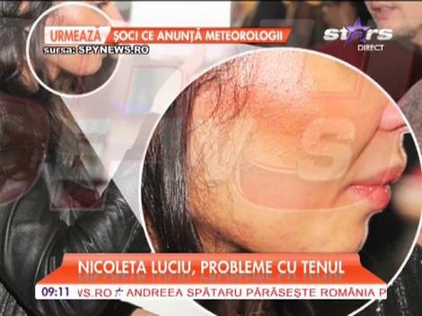 Nicoleta Luciu, probleme cu tenul