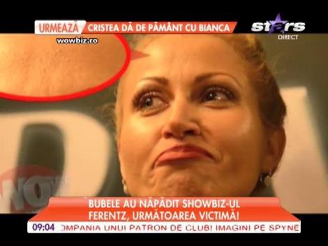 Anamaria Ferentz, plină de coşuri