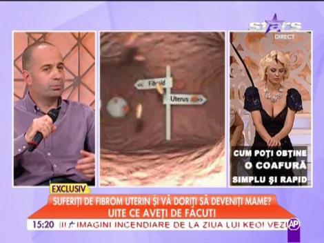 Una din trei femei suferă de fibrom uterin! Iată cum poate fi tratat!