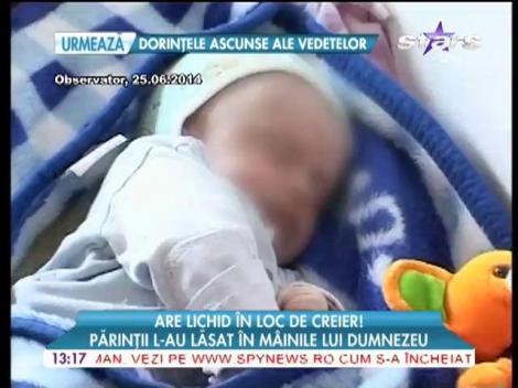 Un copil din Gorj s-a născut fără creier! Cazul lui şochează lumea medicală!