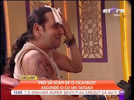 Vrei să scapi de o cicatrice? Ascunde-o cu un tatuaj!