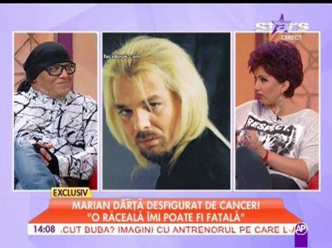 Marian Dârţă, desfigurat de cancer!