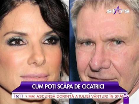 Cum poți scăpa de cicatrici