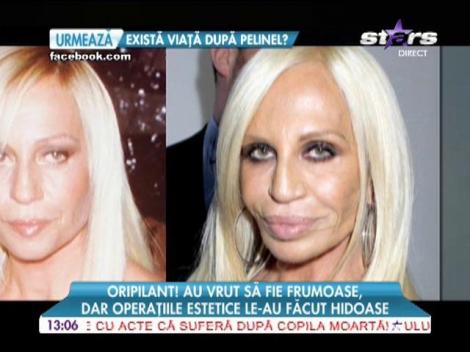 Oripilant! Au vrut să fie frumoase, dar operaţiile estetice le-au făcut hidoase