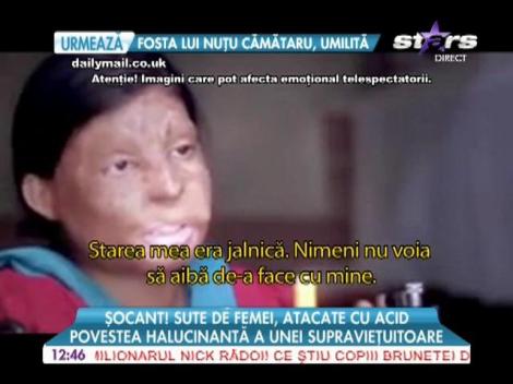 Sute de femei mutilate cu acid, în India! Povestea șocantă a unei supraviețuitoare