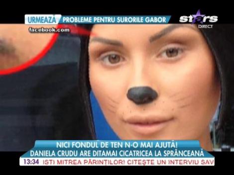Uite ce cicatrice are Cruduţa la sprânceană!