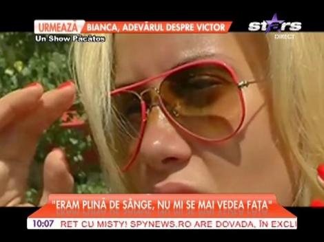 Simona Traşcă şi-a spart nasul!