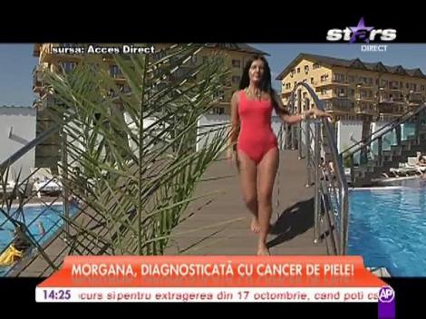 Morgana, diagnosticată cu cancer de piele!