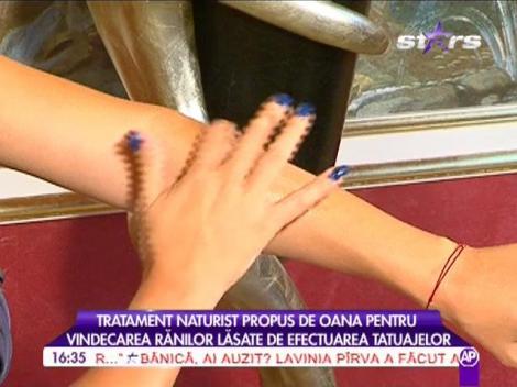 Vindecarea rănilor lăsate de efectuarea tatuajelor