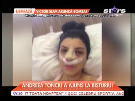 Andreea Tonciu, de nerecunoscut: "O să am un nas de păpuşă"