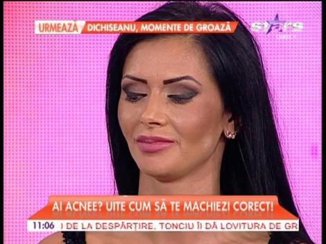 Ai acnee? Uite cum să te machiezi corect
