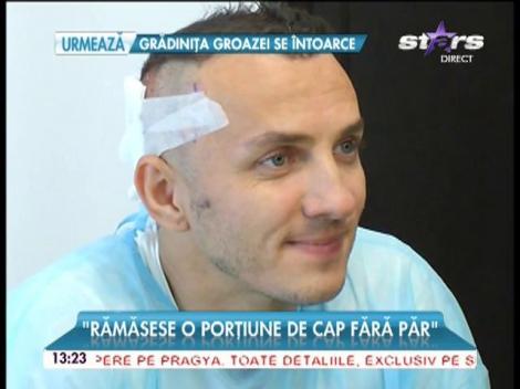 Mihai Trăistariu şi-a făcut un nou implant de păr! Imagini şi declaraţii exclusive