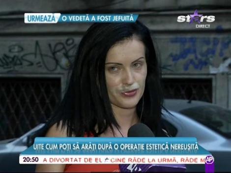 Prima apariţie TV a fatei care a rămas fără jumătate de buză după ce şi-a injectat acid hialuronic la medicul VEDETELOR! O să te cutremuri c&acirc;nd vezi cum arată