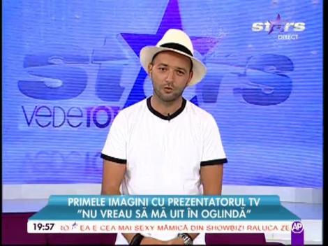 Mihai Morar și-a făcut implant de păr