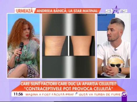 Care sunt factorii care duc la apariţia celulitei? "Contraceptivele pot provoca celulită"