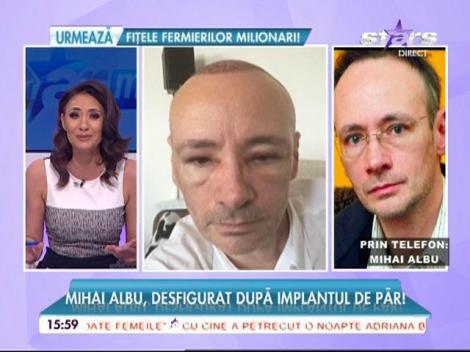 Mihai Albu, desfigurat după intervenție!